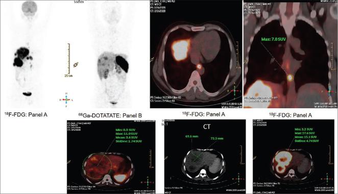 https://cdn.ncbi.nlm.nih.gov/pmc/blobs/caa2/8034780/400918c453c3/WJNM-20-125-g002.jpg