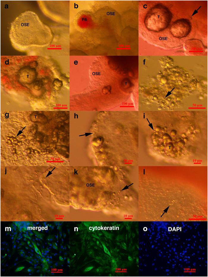https://cdn.ncbi.nlm.nih.gov/pmc/blobs/caa4/5050448/8e1bd58dd623/srep34730-f2.jpg