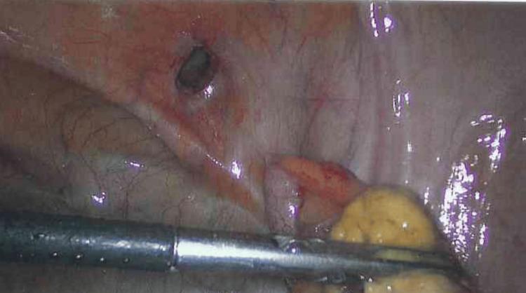 https://cdn.ncbi.nlm.nih.gov/pmc/blobs/caaa/12414523/8e3b1a411c09/cureus-0017-00000089638-i04.jpg