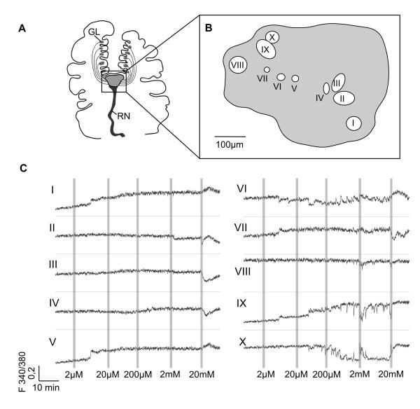 https://cdn.ncbi.nlm.nih.gov/pmc/blobs/caaa/1526719/ba5dc93d2998/1742-9994-3-6-4.jpg