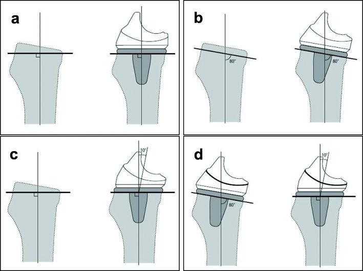 https://cdn.ncbi.nlm.nih.gov/pmc/blobs/caab/8796609/ac73494227d1/42836_2021_85_Fig2_HTML.jpg