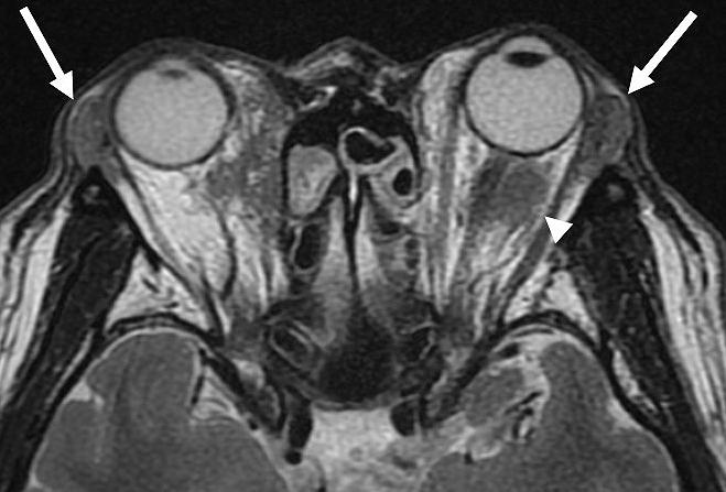 https://cdn.ncbi.nlm.nih.gov/pmc/blobs/cab1/8826784/6ebd9db0bf2e/2433-3298-5-1-0023-g005.jpg