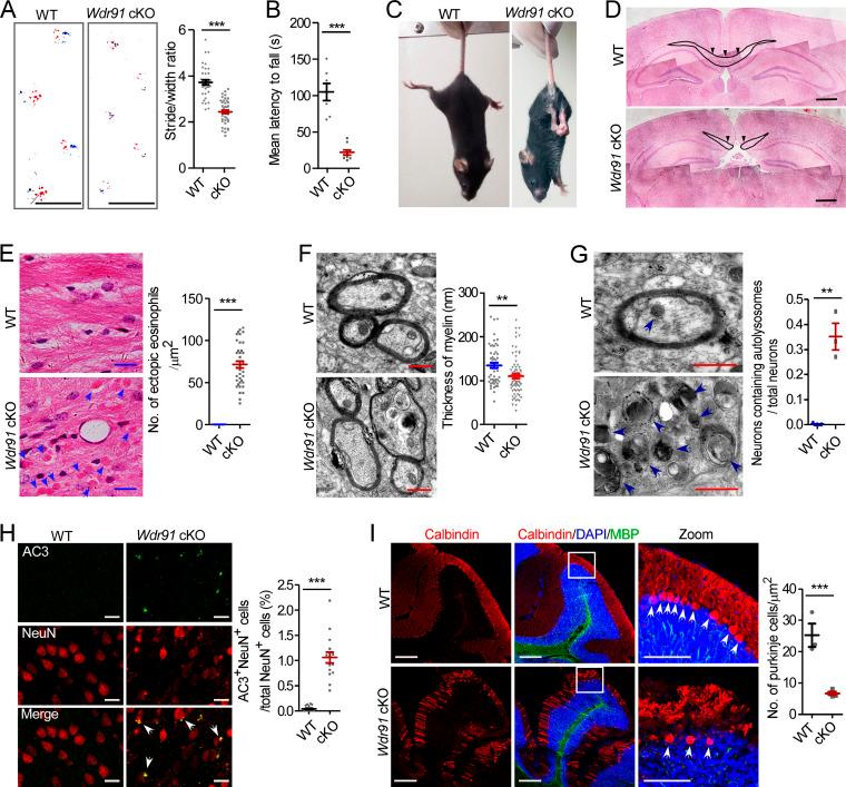 https://cdn.ncbi.nlm.nih.gov/pmc/blobs/cab6/8150682/be549ae87e51/JCB_202007061_Fig1.jpg