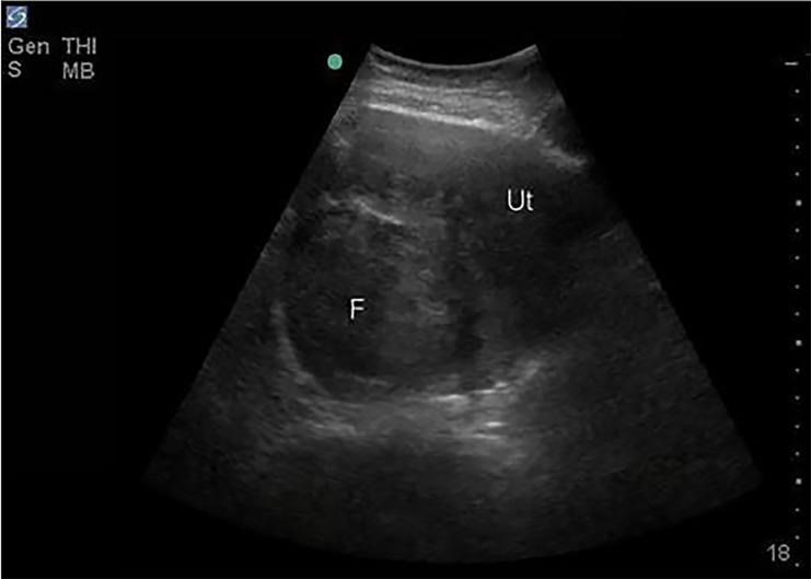 https://cdn.ncbi.nlm.nih.gov/pmc/blobs/cab7/6230347/2df93032b4a4/cpcem-02-320-g002.jpg