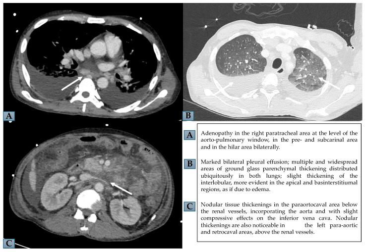 https://cdn.ncbi.nlm.nih.gov/pmc/blobs/cab8/11173133/bb082fbeb380/ijms-25-05921-g001.jpg
