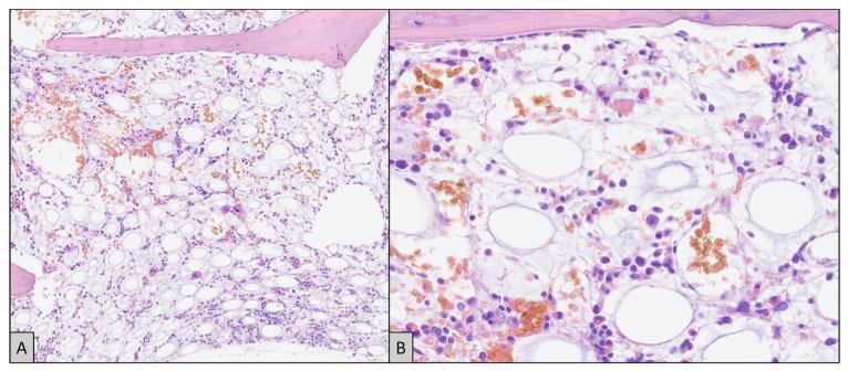 https://cdn.ncbi.nlm.nih.gov/pmc/blobs/cab8/11173133/cbbd4d691f05/ijms-25-05921-g002.jpg