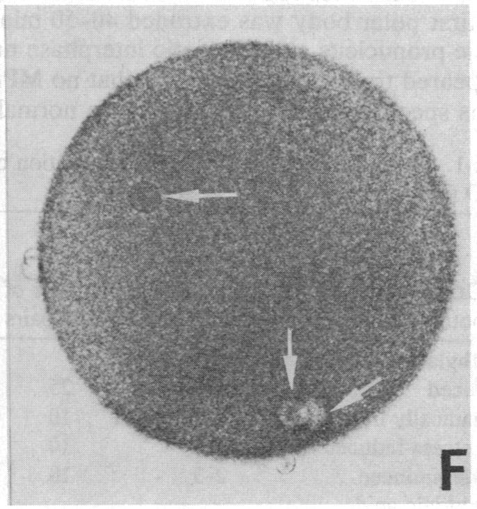 https://cdn.ncbi.nlm.nih.gov/pmc/blobs/cab8/323832/560623128e19/pnas00317-0242-f.jpg