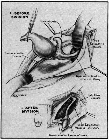 https://cdn.ncbi.nlm.nih.gov/pmc/blobs/caba/1575399/ff3d335f3959/califmed00168-0075-b.jpg