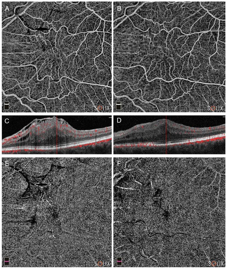 https://cdn.ncbi.nlm.nih.gov/pmc/blobs/cac0/10888329/a83e5e7b4c42/diagnostics-14-00411-g004.jpg