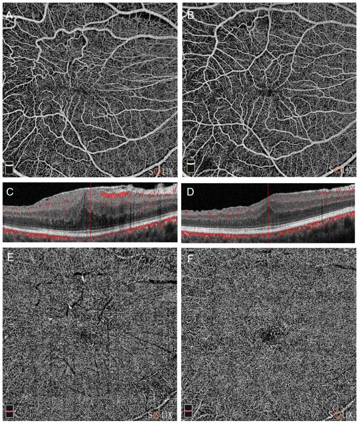 https://cdn.ncbi.nlm.nih.gov/pmc/blobs/cac0/10888329/b26f359e83c9/diagnostics-14-00411-g002.jpg