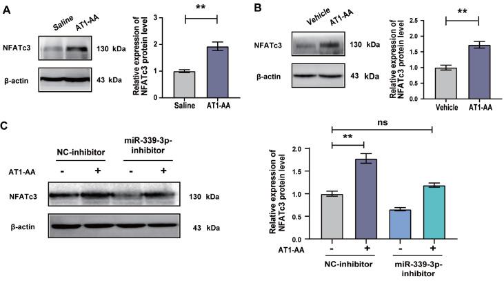 https://cdn.ncbi.nlm.nih.gov/pmc/blobs/cad0/10157516/6f2592bcc597/abbs-2022-279-t5.jpg