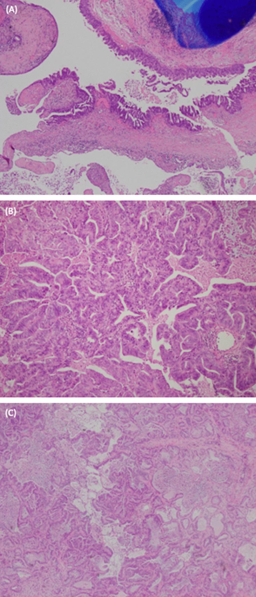 https://cdn.ncbi.nlm.nih.gov/pmc/blobs/cad1/12150467/cb6235046e3d/13256_2025_5140_Fig3_HTML.jpg