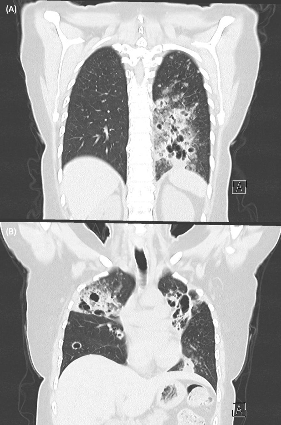 https://cdn.ncbi.nlm.nih.gov/pmc/blobs/cad1/12150467/fbbea0629ed6/13256_2025_5140_Fig2_HTML.jpg