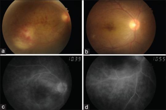 https://cdn.ncbi.nlm.nih.gov/pmc/blobs/cad9/6169326/6826dca2c8fd/TJO-8-168-g001.jpg