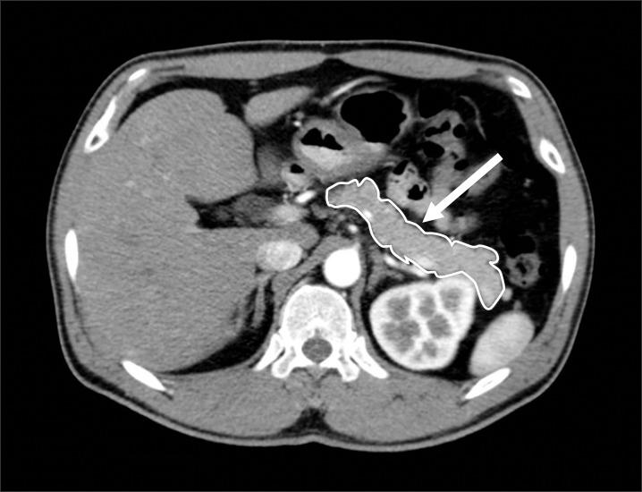 https://cdn.ncbi.nlm.nih.gov/pmc/blobs/cae3/4582551/adbad0d3ba4a/kjhbps-15-123-g001.jpg