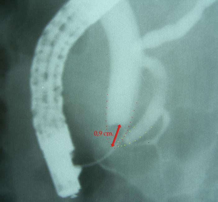 https://cdn.ncbi.nlm.nih.gov/pmc/blobs/cae5/3945241/c02c2fde0757/CHSJ-35-2-092-fig1a.jpg