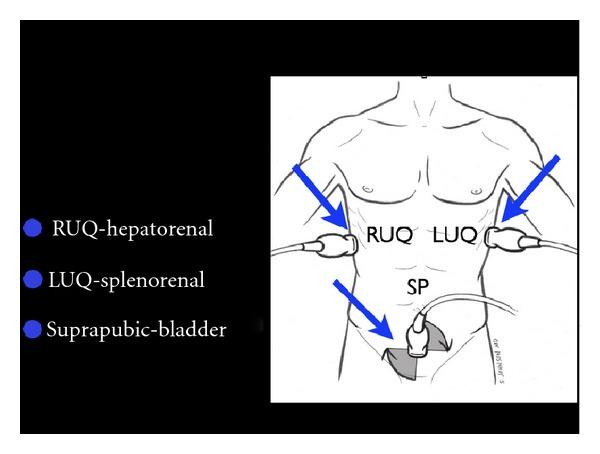 https://cdn.ncbi.nlm.nih.gov/pmc/blobs/caeb/3485910/03c0d50cab05/CCRP2012-503254.017.jpg