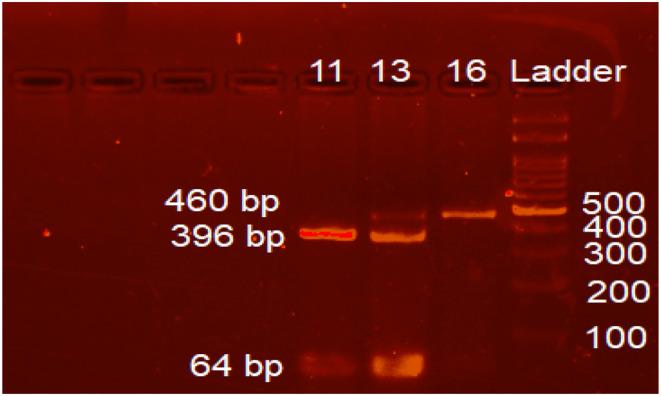 https://cdn.ncbi.nlm.nih.gov/pmc/blobs/caee/11821720/80d424e7ef04/JCLA-39-e25147-g002.jpg
