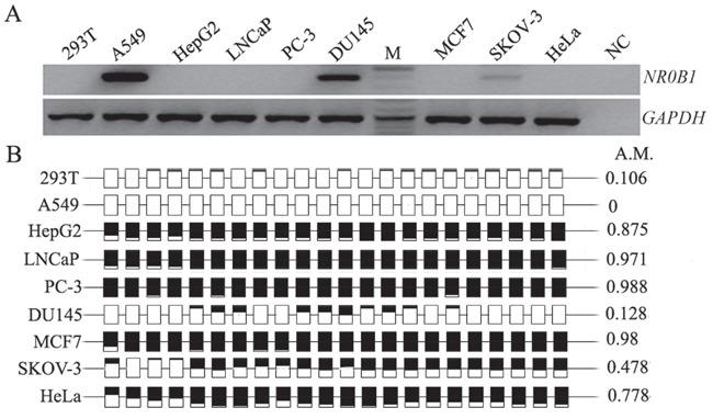 https://cdn.ncbi.nlm.nih.gov/pmc/blobs/caee/5190015/6b71e6e439fa/oncotarget-07-43162-g003.jpg