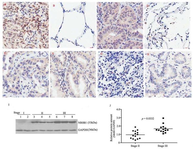 https://cdn.ncbi.nlm.nih.gov/pmc/blobs/caee/5190015/de7948365c5c/oncotarget-07-43162-g001.jpg
