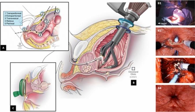https://cdn.ncbi.nlm.nih.gov/pmc/blobs/caf0/11032265/fbc6b15e6d8f/345_2024_4914_Fig1_HTML.jpg