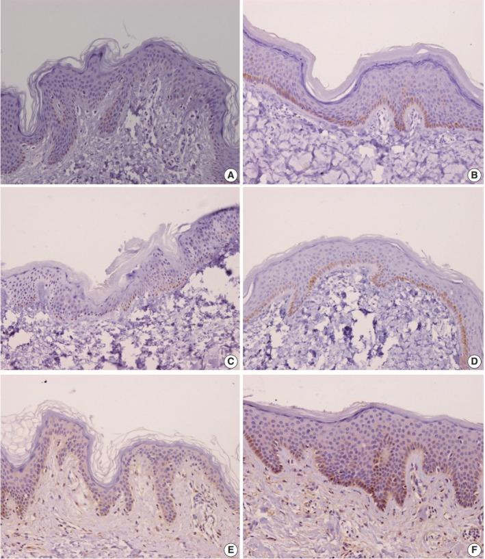 https://cdn.ncbi.nlm.nih.gov/pmc/blobs/caf0/6166012/768e77ea55af/jptm-2018-08-03f1.jpg