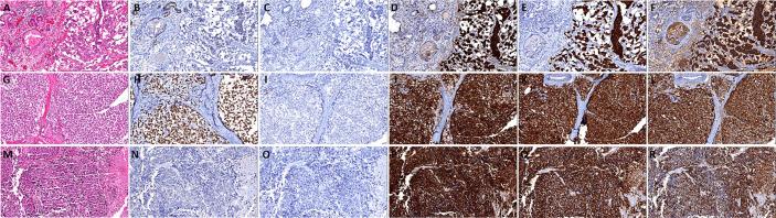 https://cdn.ncbi.nlm.nih.gov/pmc/blobs/caf5/7882702/326ea0429c99/fonc-10-571308-g003.jpg