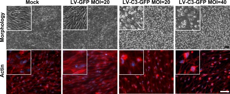https://cdn.ncbi.nlm.nih.gov/pmc/blobs/caf6/6187949/7f0464db7cf8/i1552-5783-59-12-4937-f02.jpg