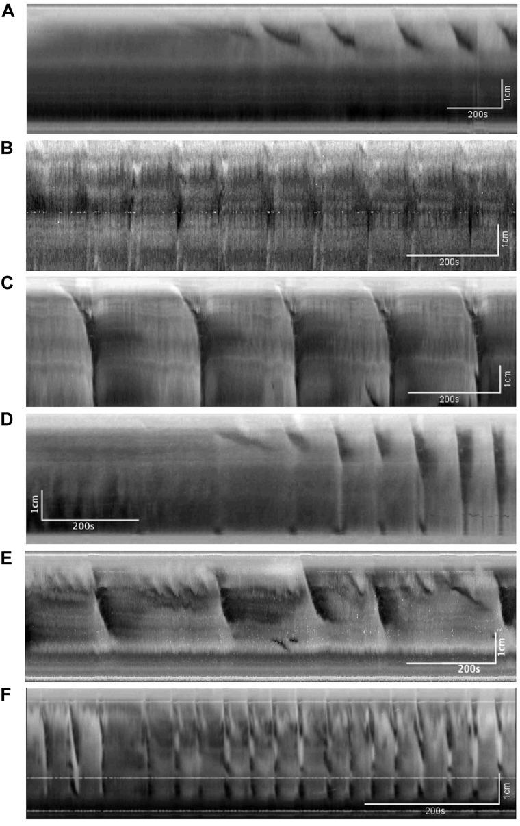 https://cdn.ncbi.nlm.nih.gov/pmc/blobs/cafa/7040375/bcaef8ae02f5/fphys-11-00109-g002.jpg