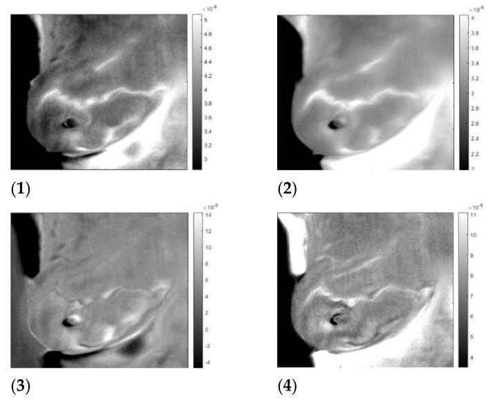 https://cdn.ncbi.nlm.nih.gov/pmc/blobs/cafb/10057499/4f64774ee12b/sensors-23-03012-g009.jpg