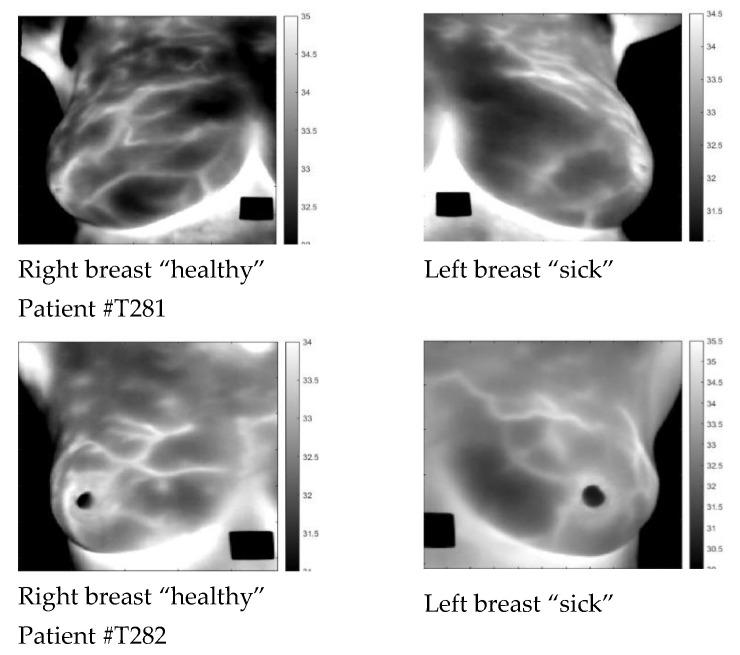 https://cdn.ncbi.nlm.nih.gov/pmc/blobs/cafb/10057499/6c9008c1126f/sensors-23-03012-g001.jpg