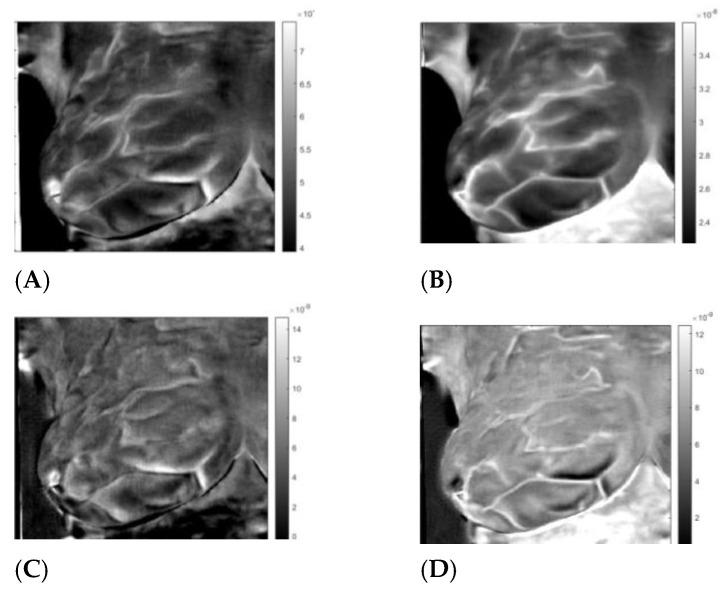 https://cdn.ncbi.nlm.nih.gov/pmc/blobs/cafb/10057499/79eb5184581b/sensors-23-03012-g006.jpg