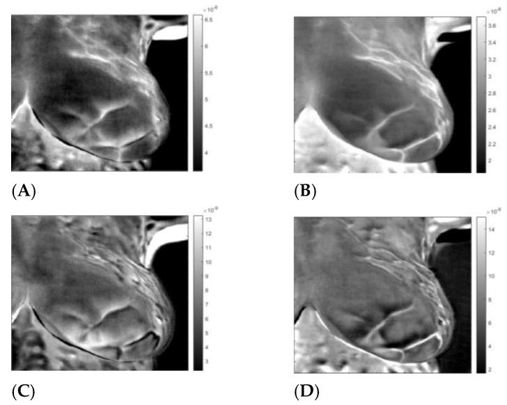 https://cdn.ncbi.nlm.nih.gov/pmc/blobs/cafb/10057499/ab210a4701e8/sensors-23-03012-g007.jpg