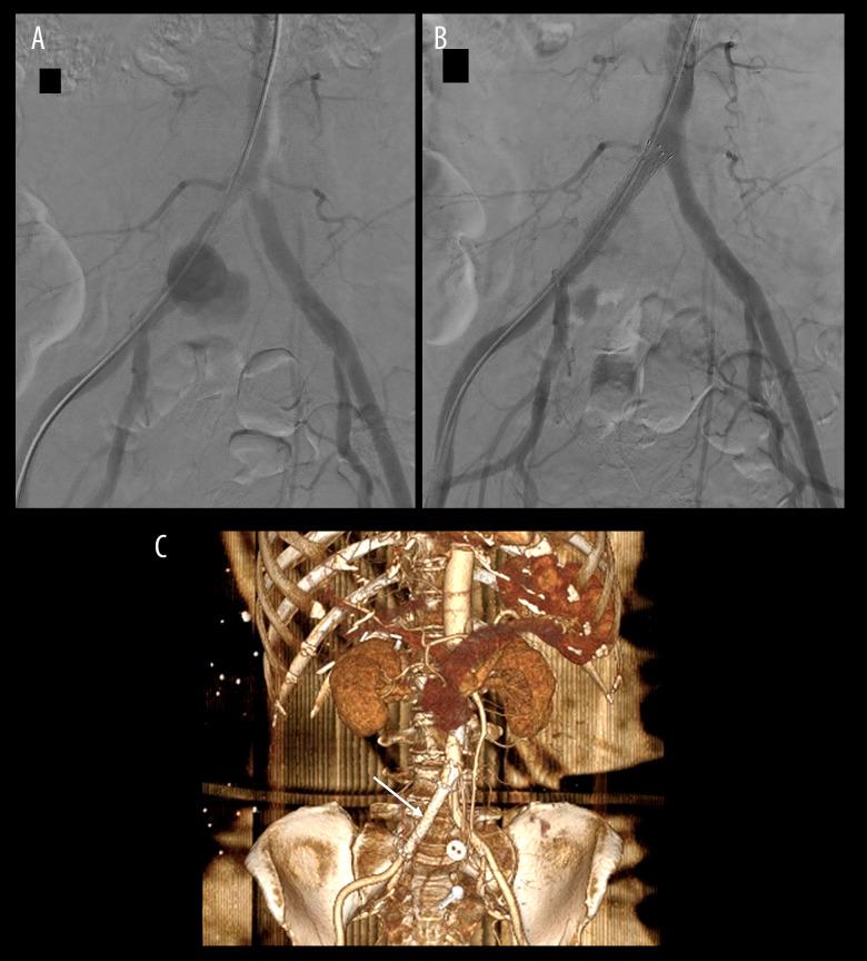 https://cdn.ncbi.nlm.nih.gov/pmc/blobs/cafd/10868599/178caa451955/amjcaserep-25-e942727-g002.jpg