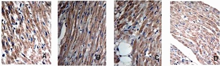 https://cdn.ncbi.nlm.nih.gov/pmc/blobs/cb08/6381473/14888f297b0d/10.1177_0300060518799819-fig5.jpg