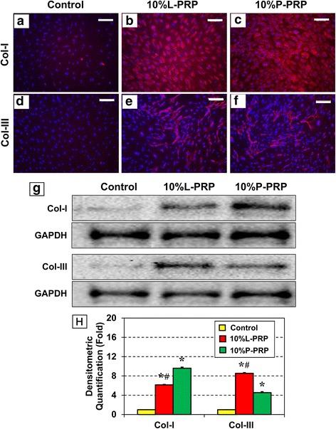 https://cdn.ncbi.nlm.nih.gov/pmc/blobs/cb0c/4572462/5063aa4ffd2c/13287_2015_172_Fig4_HTML.jpg