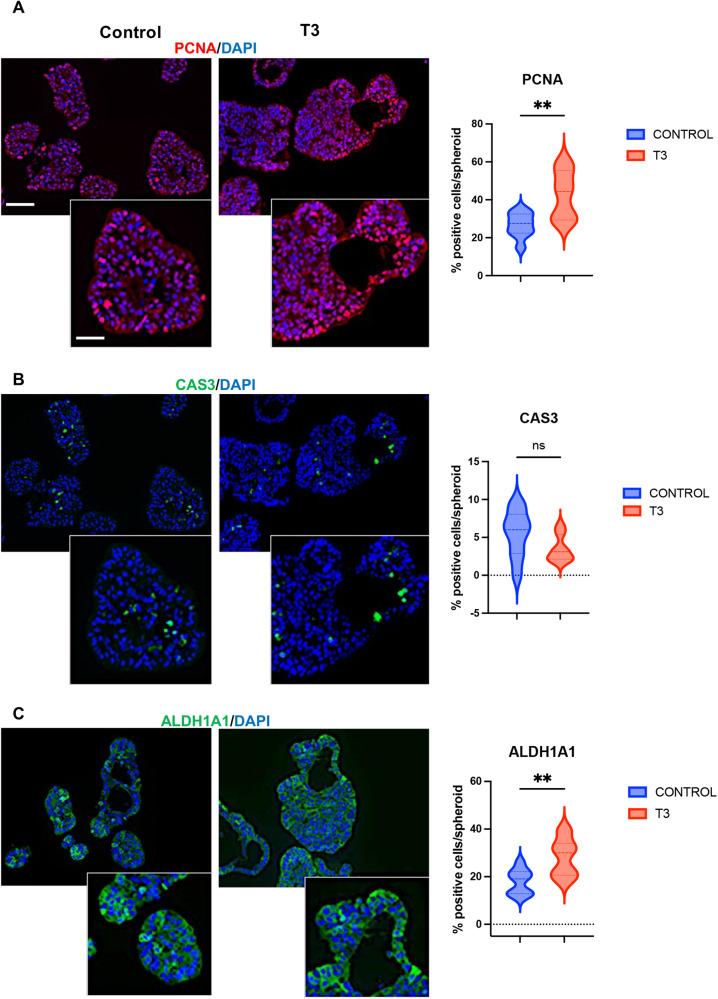 https://cdn.ncbi.nlm.nih.gov/pmc/blobs/cb12/11063186/c72ff9b0b57b/41419_2024_6690_Fig2_HTML.jpg