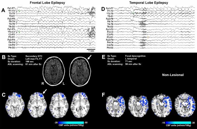 https://cdn.ncbi.nlm.nih.gov/pmc/blobs/cb15/5154758/8216ef6a7def/elife-19352-fig3.jpg