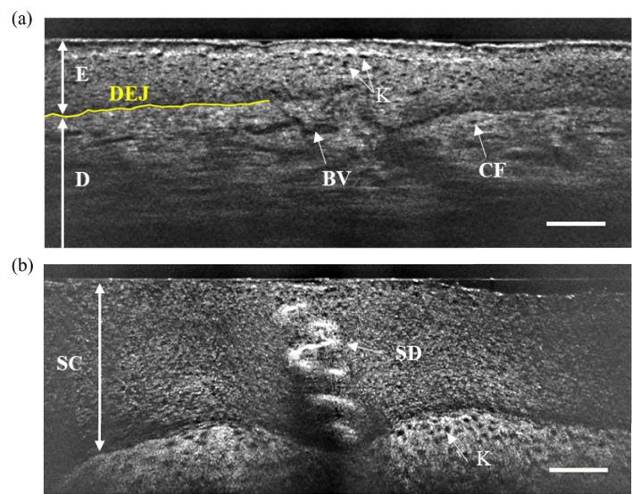 https://cdn.ncbi.nlm.nih.gov/pmc/blobs/cb19/11407268/8421c2592a2e/boe-15-9-5384-g008.jpg