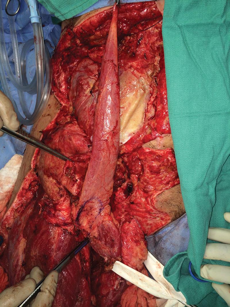 https://cdn.ncbi.nlm.nih.gov/pmc/blobs/cb20/6191209/aee2442df309/gox-6-e1852-g003.jpg