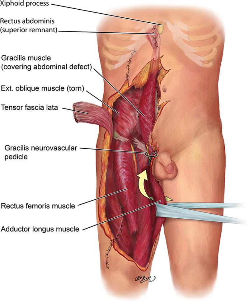 https://cdn.ncbi.nlm.nih.gov/pmc/blobs/cb20/6191209/cf23ece33afb/gox-6-e1852-g002.jpg