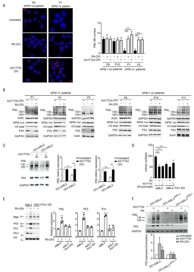 https://cdn.ncbi.nlm.nih.gov/pmc/blobs/cb20/8634200/711dc693aa2b/1063090.fig2.jpg