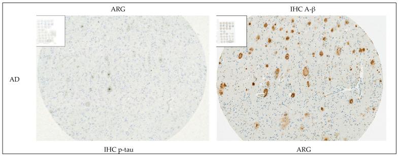 https://cdn.ncbi.nlm.nih.gov/pmc/blobs/cb22/12190736/7ffc96357a38/cells-14-00869-g0A9a.jpg