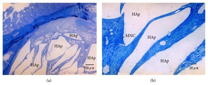 https://cdn.ncbi.nlm.nih.gov/pmc/blobs/cb24/4609359/4030a9babeeb/BMRI2015-579541.006.jpg