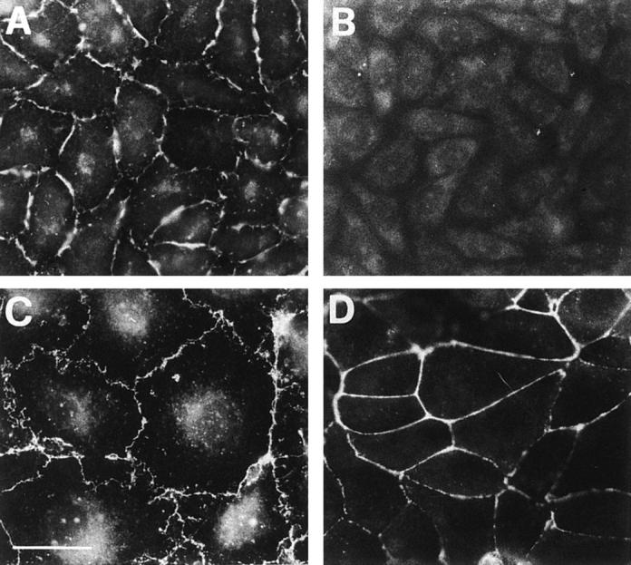 https://cdn.ncbi.nlm.nih.gov/pmc/blobs/cb2c/2133024/56e58755503f/JCB15155.f7.jpg