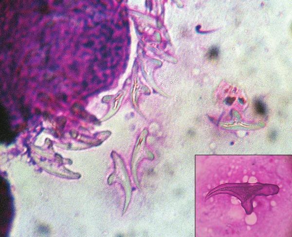 https://cdn.ncbi.nlm.nih.gov/pmc/blobs/cb30/3680874/629e6b80f91e/TP-2-127-g002.jpg