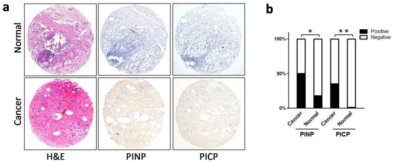 https://cdn.ncbi.nlm.nih.gov/pmc/blobs/cb33/5479253/ab7242766d6d/jcav08p1466g002.jpg