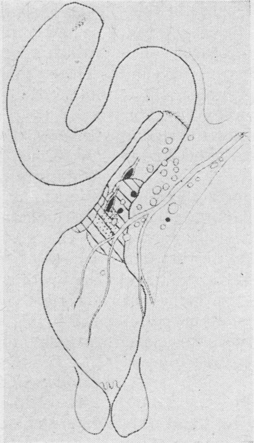 https://cdn.ncbi.nlm.nih.gov/pmc/blobs/cb3f/1870410/8e1d7d86e60d/procrsmed00244-0135-b.jpg