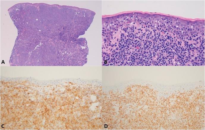 https://cdn.ncbi.nlm.nih.gov/pmc/blobs/cb43/11776889/52869ab1b142/ajd-47-145-g005.jpg