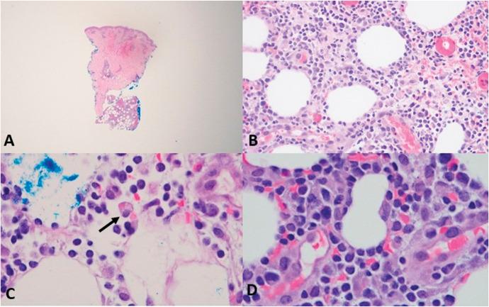 https://cdn.ncbi.nlm.nih.gov/pmc/blobs/cb43/11776889/cdc024041494/ajd-47-145-g002.jpg